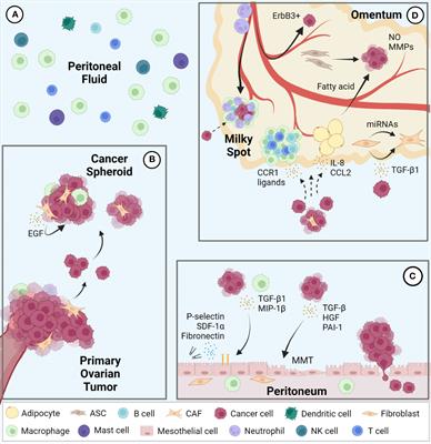 Intraperitoneal metastasis of ovarian cancer: new insights on resident macrophages in the peritoneal cavity